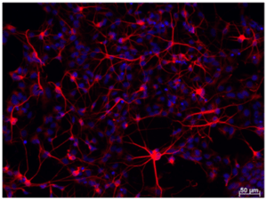 growth factor | Stained cells after growth with BDNF and GDNF StemBeads